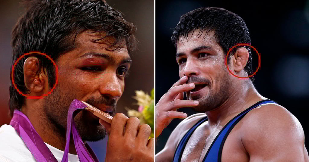 Wrestlers Around the World Have Weird Ears, Ever Wondered Why?